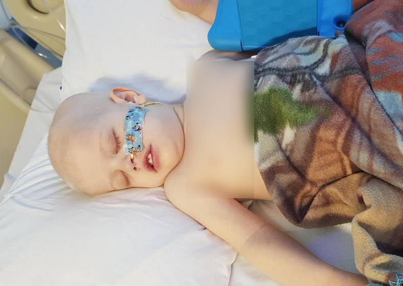 Parents believed their 2-year-old son is easily upset, until this appeared on his stomach and the boy was left fighting for his life!