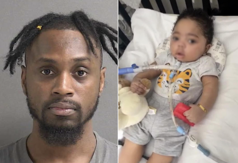 Father shook his 3-month-old baby so hard the child went into cardiac arrest and his heart stopped for 16 minutes; the now-11-months-old baby still remains at the hospital on life support!